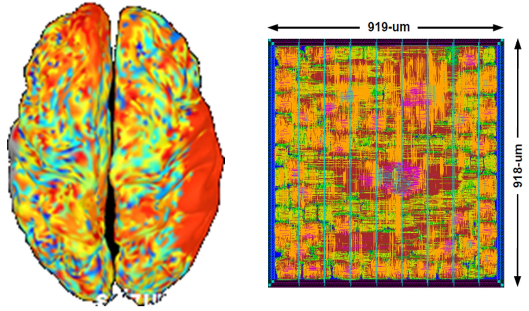 brain chip