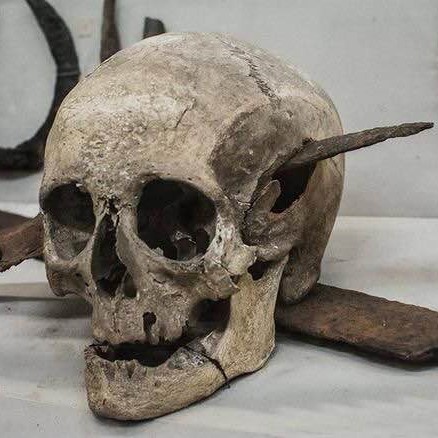 Skull of a Roman soldier who died during the Gallic Wars, first century BC